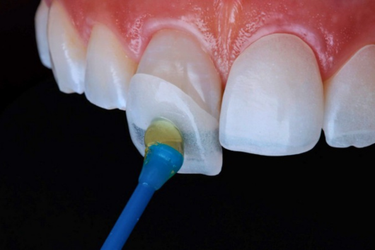 Untitled design (17)